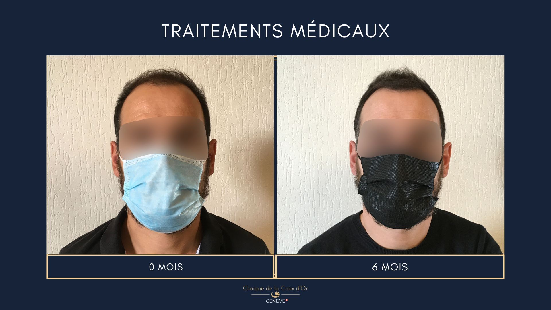 Traitements médicaux