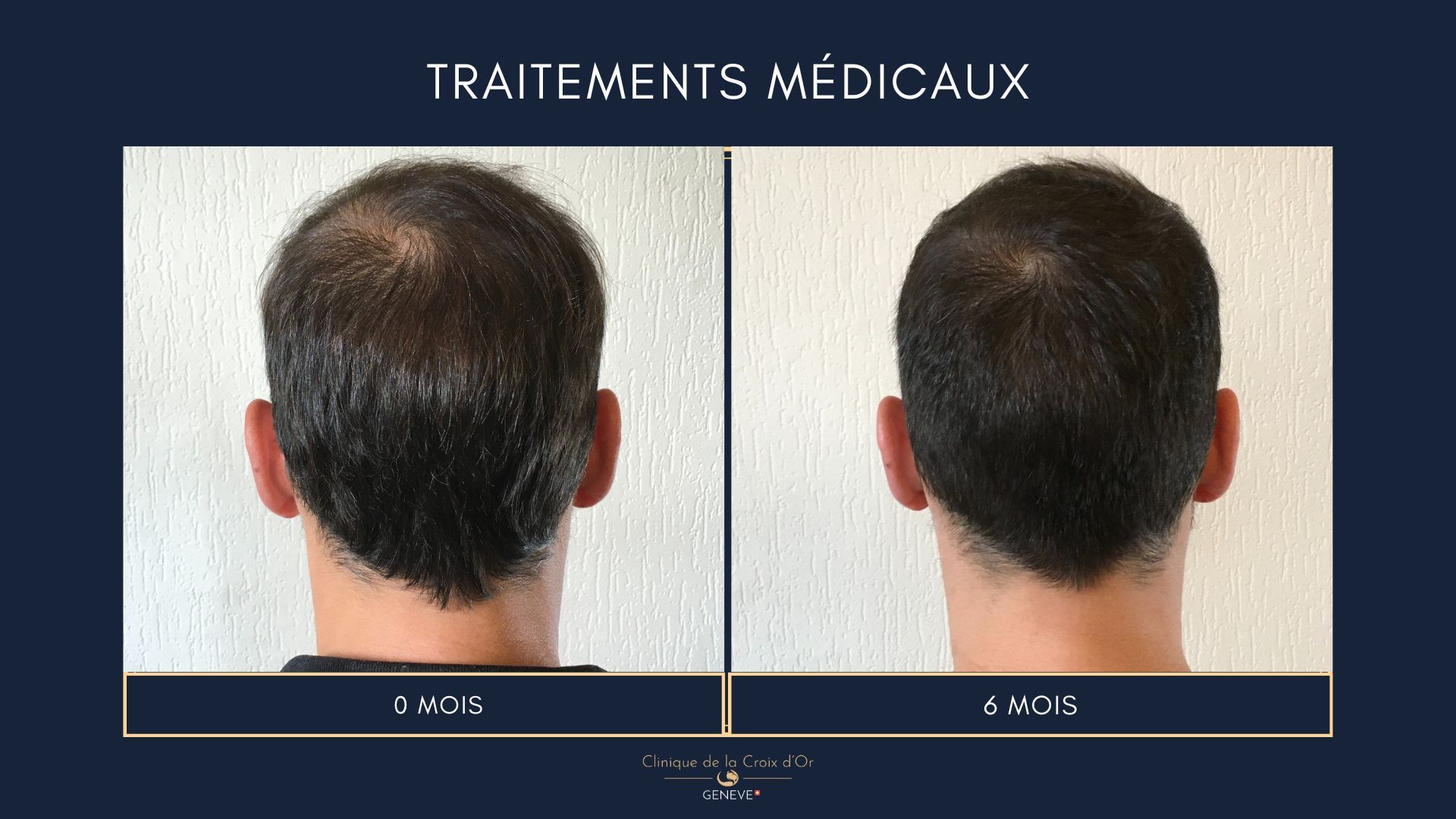 Traitements médicaux