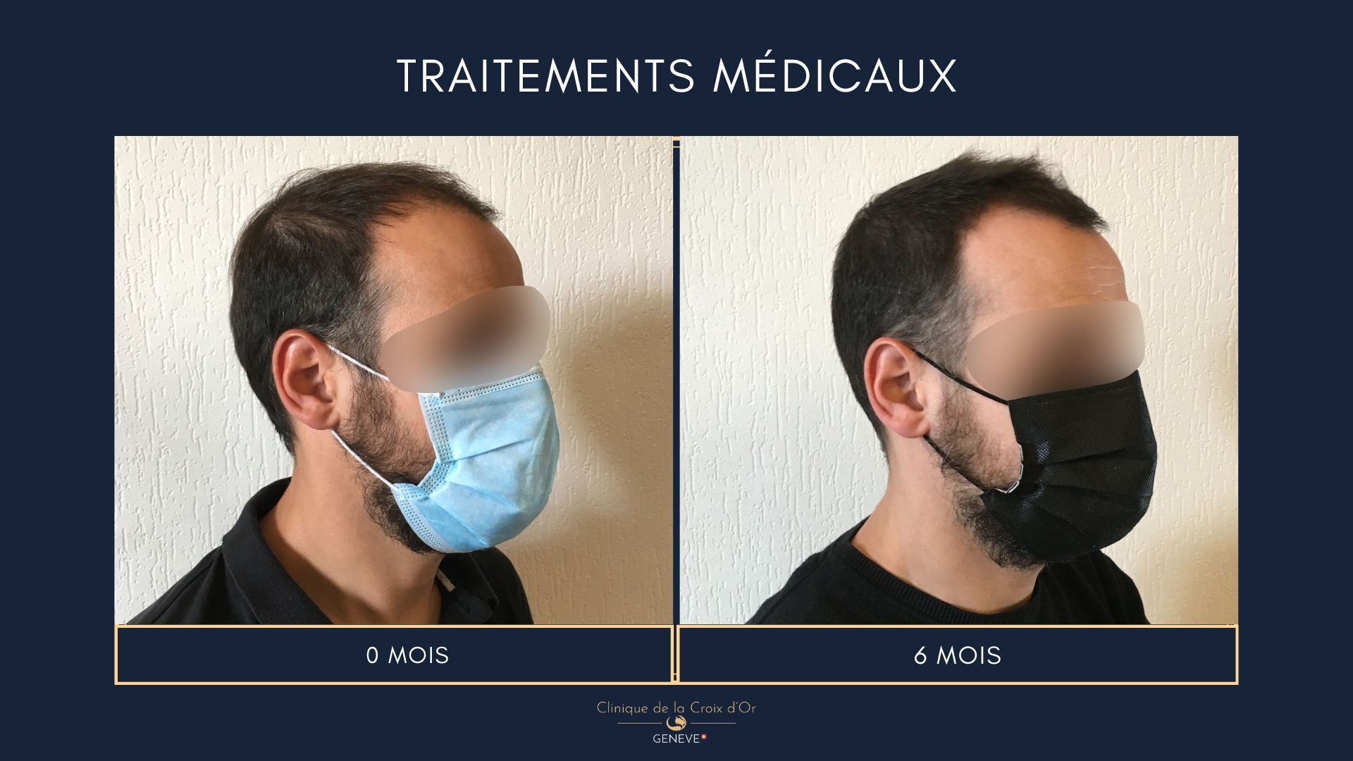 Traitements médicaux