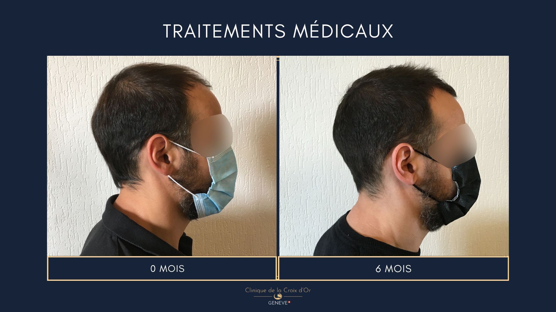 Traitements médicaux