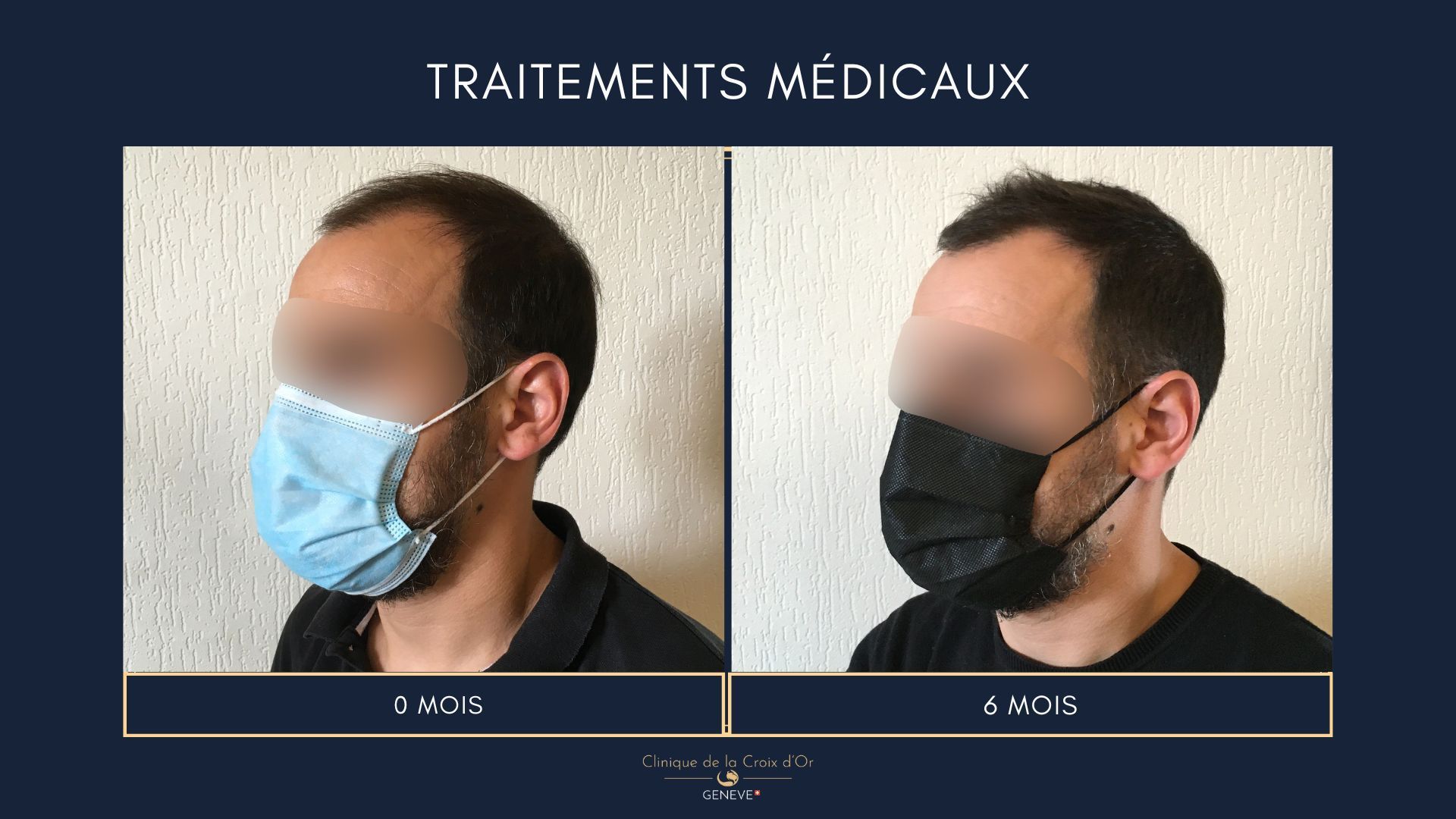 Traitements médicaux