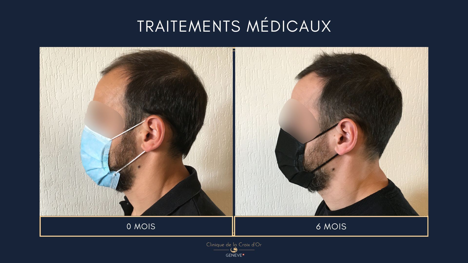 Traitements médicaux
