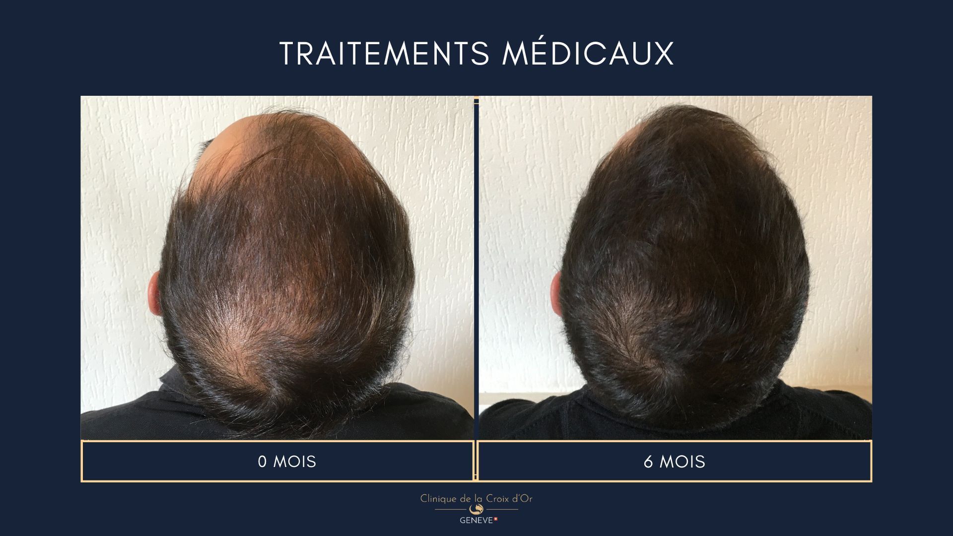 Traitements médicaux