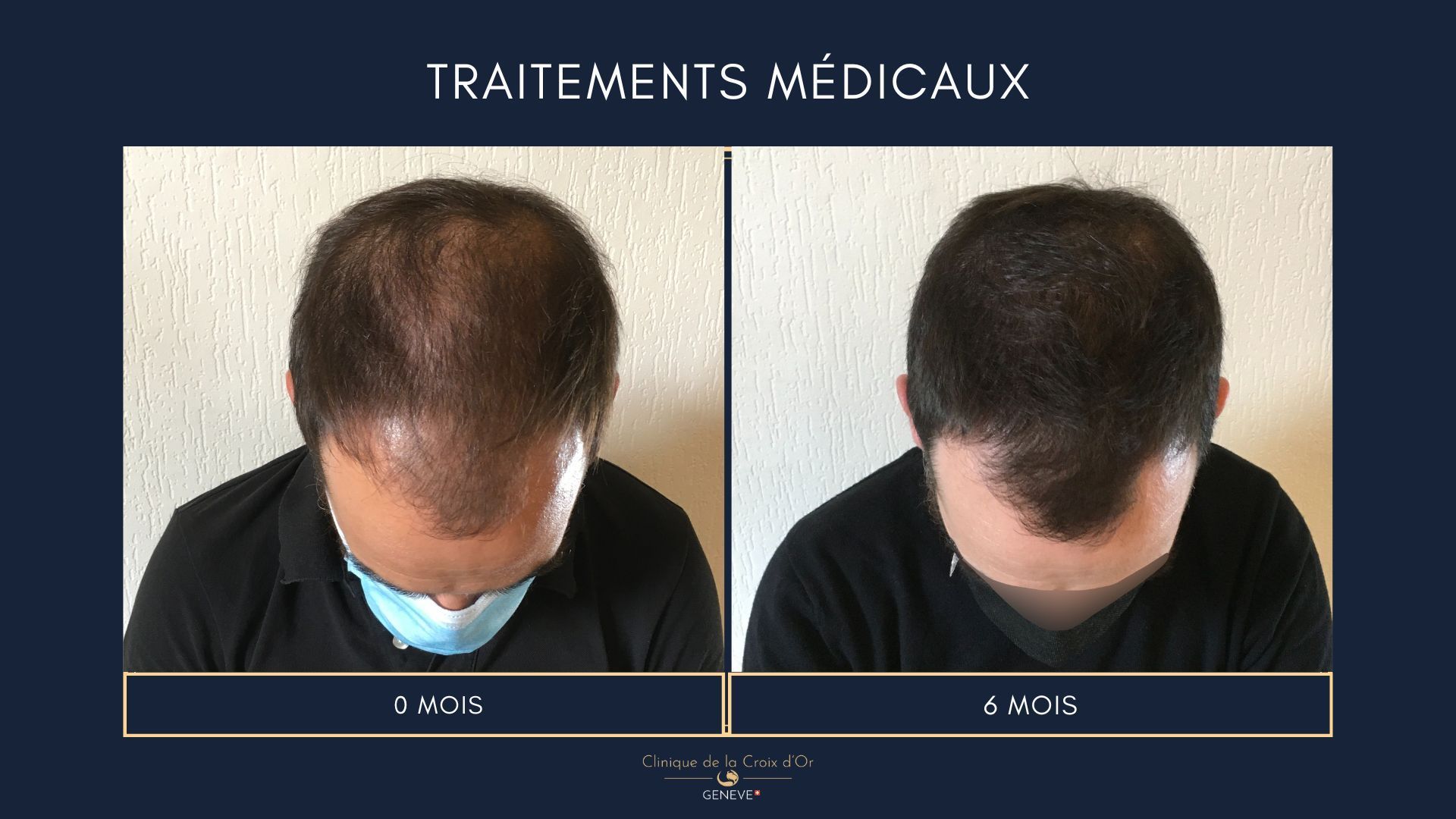 Traitements médicaux