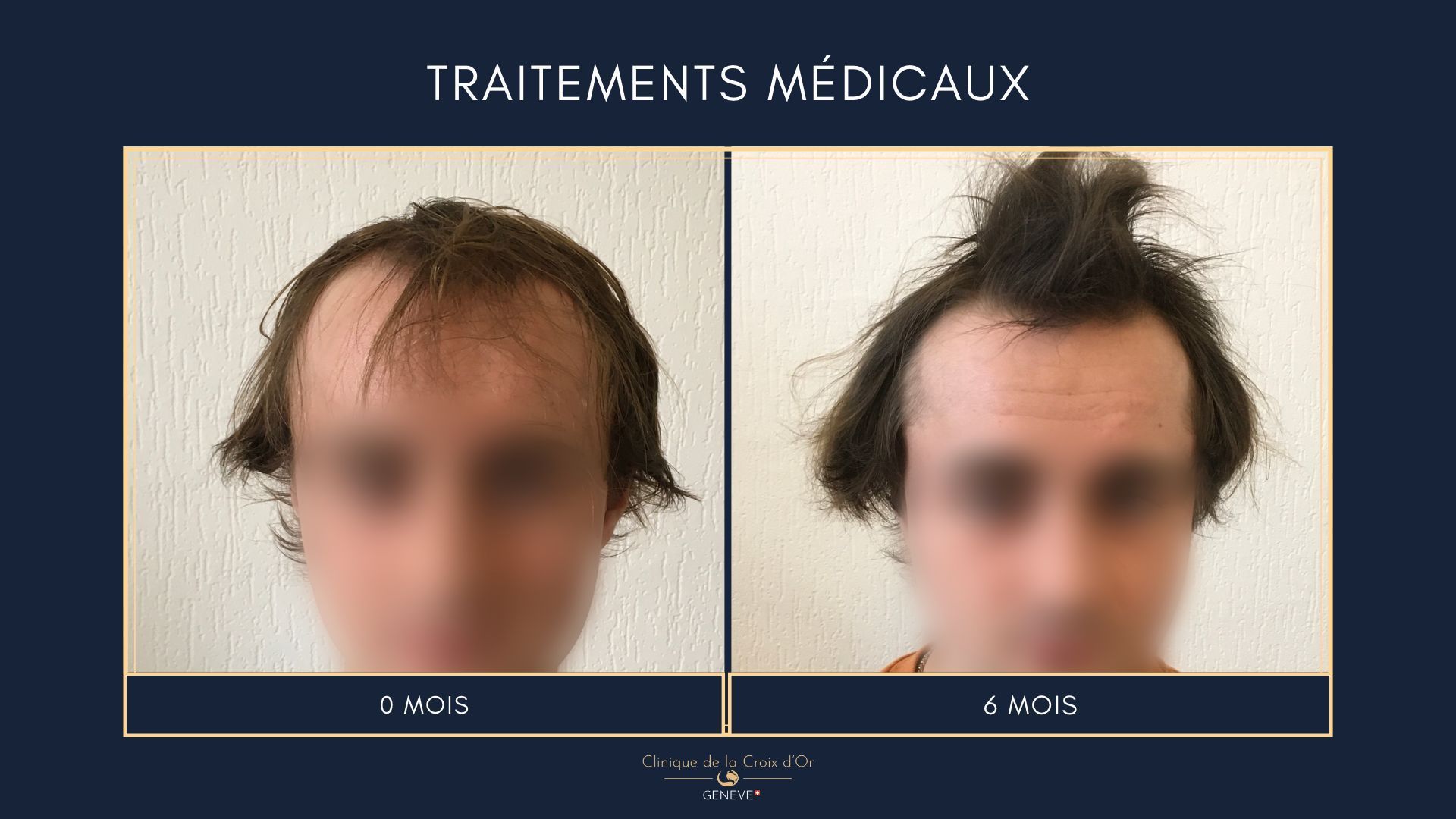 Traitements médicaux