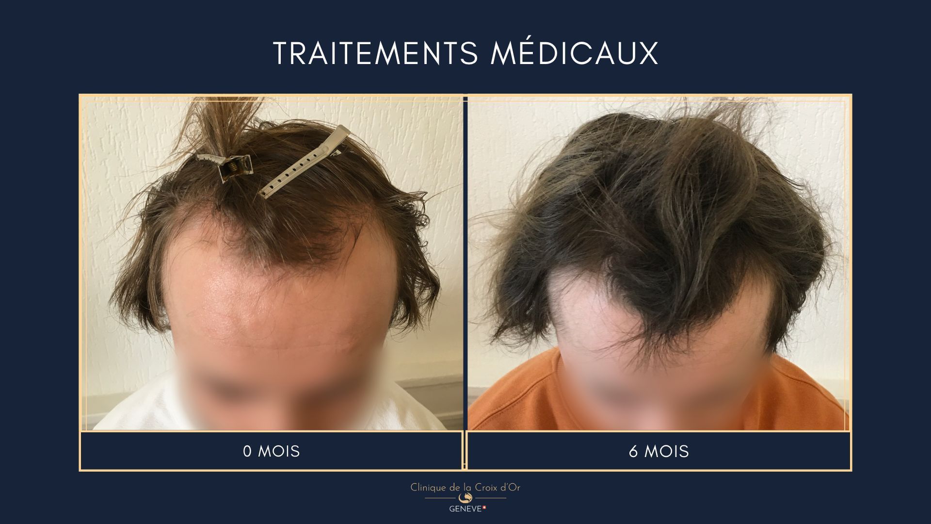 Traitements médicaux