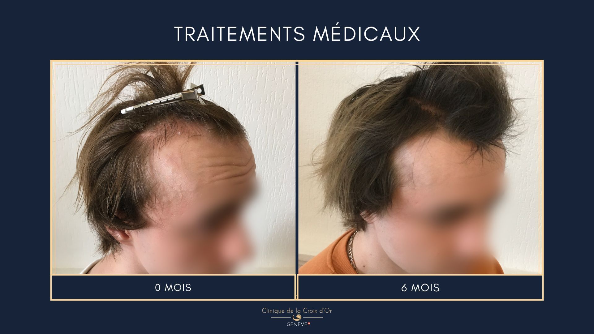Traitements médicaux
