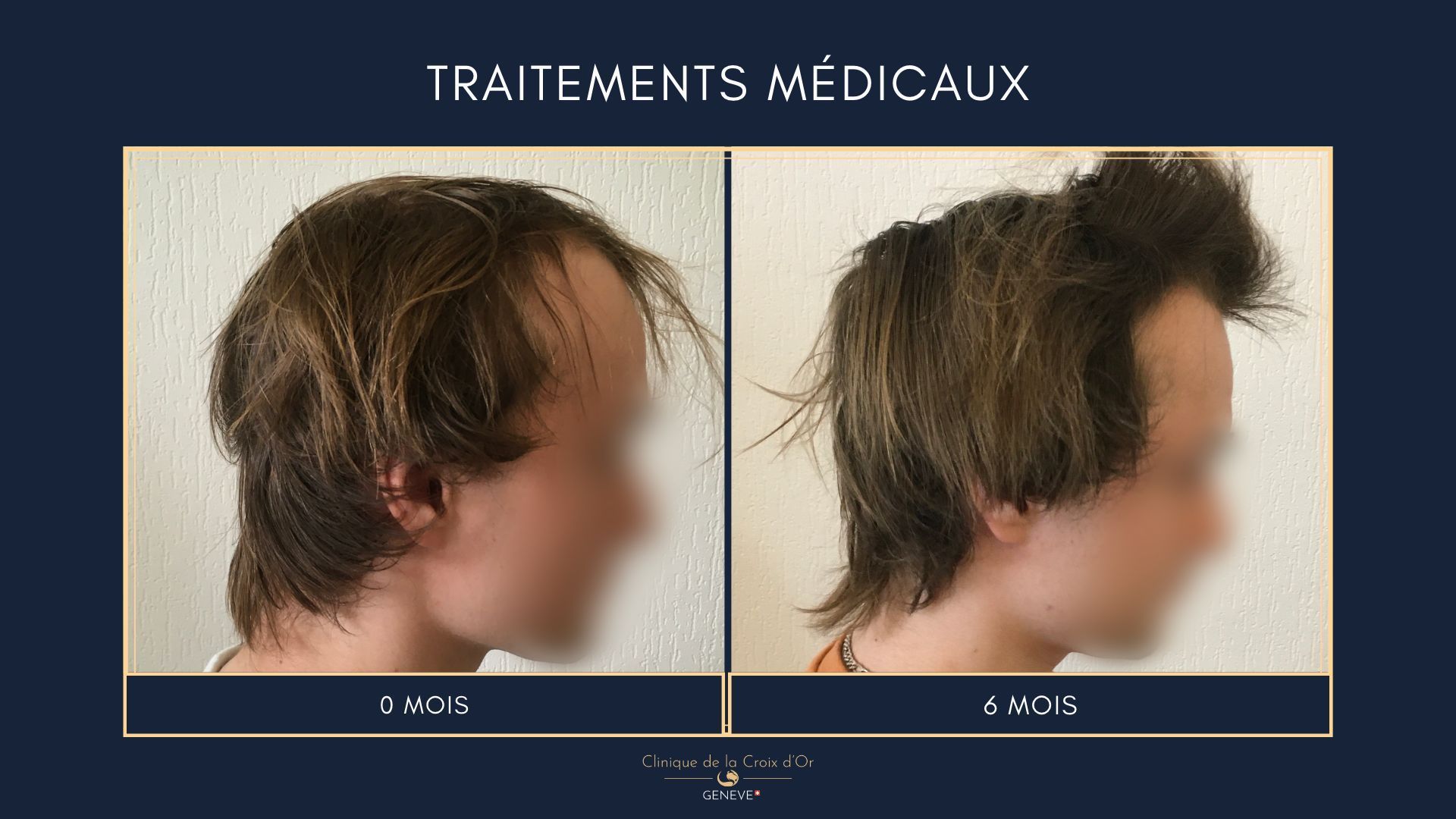 Traitements médicaux