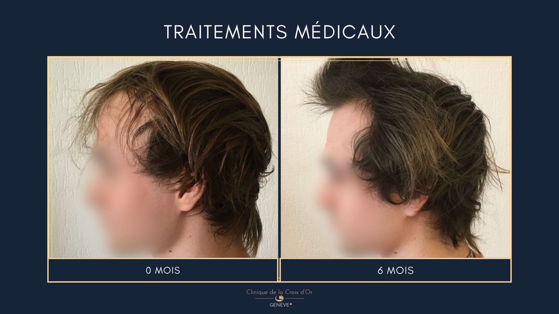 Traitements médicaux