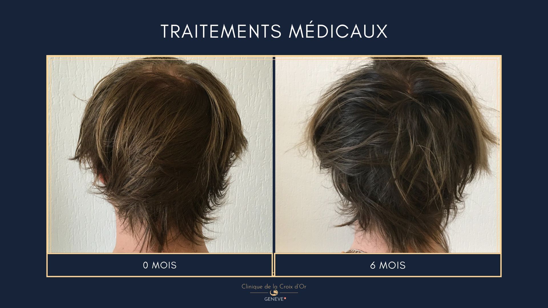 Traitements médicaux